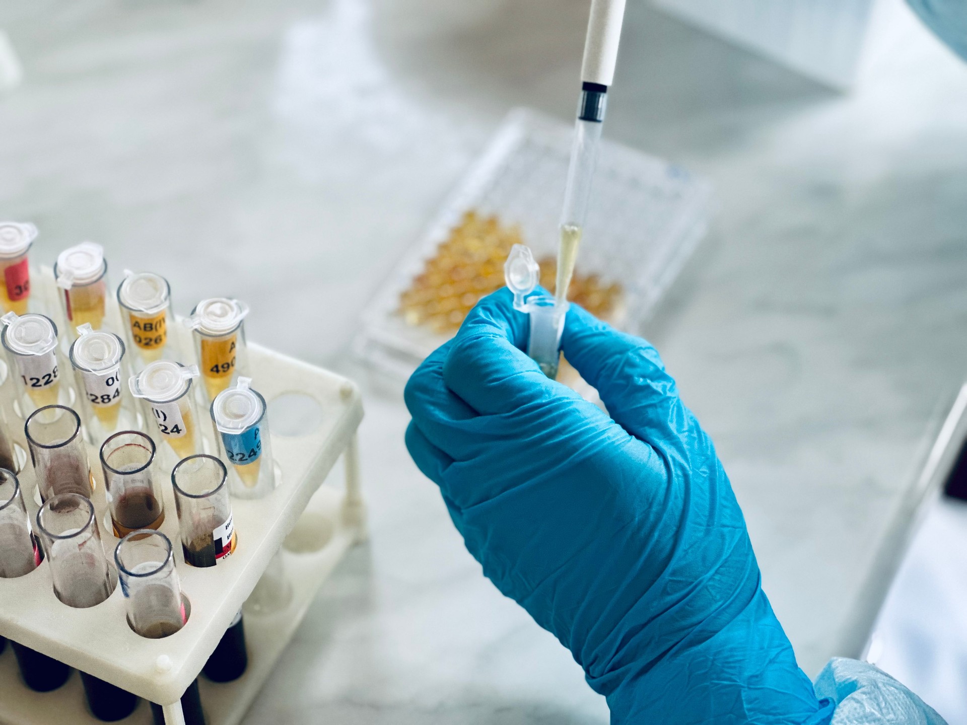 Enzyme-linked Immunosorbent Assay (ELISA) plate, Immunology or serology testing method in medical laboratory